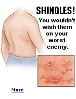 Shingles is a painful skin disease caused by a reactivation of the chickenpox virus. Half of those 60 to 80 years old will be affected.